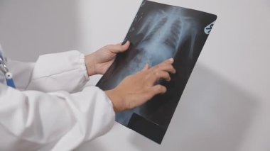 Doktor röntgeni inceliyor.