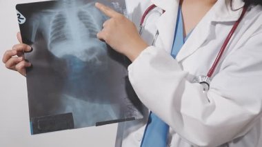 Doktor klinikte röntgeni inceliyor.