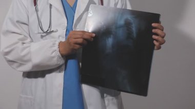 Beyaz önlüklü doktor gri arka planda röntgen tutuyor, yakın plan.