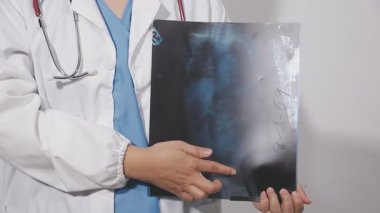 Doktor X-ray filmi tutuyor.