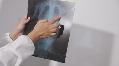 Doktor röntgen ışınlarını gösteriyor.