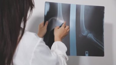 Beyaz önlüklü doktor elinde bir röntgen tutuyor..