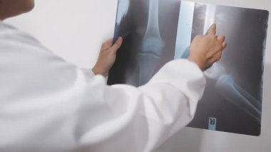 Genç bayan doktor röntgeni inceliyor.