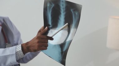 Doktor X-ray 'i inceliyor.