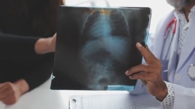 Doktor X-ray 'i inceliyor.