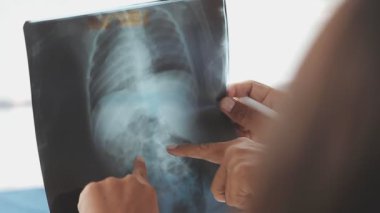 Göğüs röntgeni tutan kadın doktor.