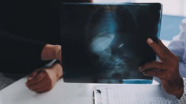 Doktor hastane ofisindeki hastanın röntgenini gösteriyor.