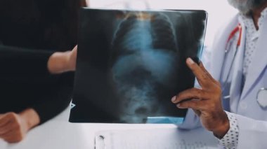 Doktor hastanedeki hastanın röntgenini inceliyor.