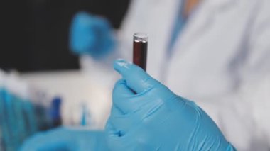 Bilim adamı deney tüpüyle tüp tutuyor.