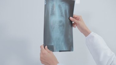 Doktor elinde röntgen tutuyor.