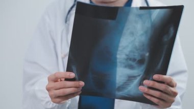 Beyaz üniformalı doktor hastanede göğüs röntgenini inceliyor.