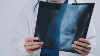 Hastanenin arka planında bir hastanın röntgen görüntüsüne sahip doktor, tıbbi konsept.