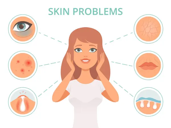 Skin problems. Beauty woman scrub care face infection darkness scrubs oily face cleanse vector symbols. Illustration skin dermatology problem, face beauty and care