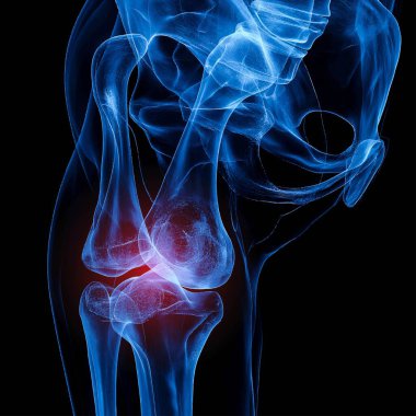 Koyu mavi arka planda insan dizi kemiği, beyaz yaralanma x-ray flim, sağlık ve tıp konsepti.