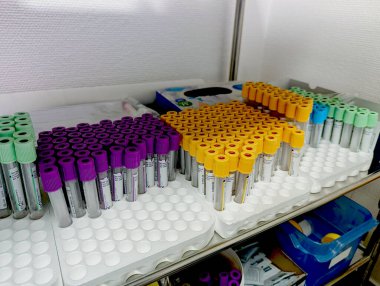  Test tüpleriyle dolu testler için bir laboratuvar.