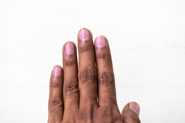 Beyaz arka planda kirli tırnakları olan bir el. Tırnaklarının altındaki pislikleri yakından çek. Tırnak altlarındaki toprak bir enfeksiyon kaynağıdır ve kişisel hijyen eksikliğine işaret eder..