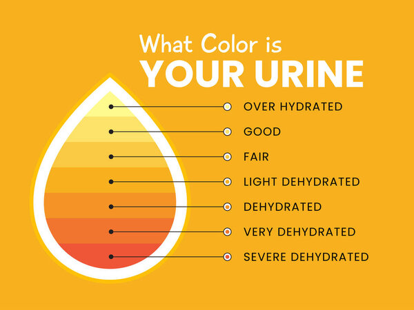Infographic about Urine Color in Orange background.