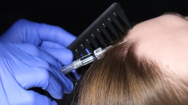 一位医生将血浆注入大脑 头发在头上生长的过程 头发损失问题 — 图库视频影像