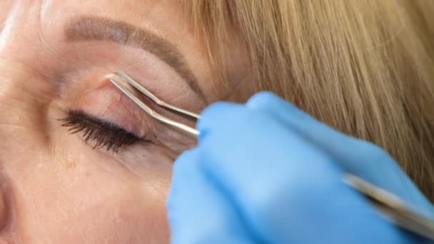 クローズアップ 目の領域を変更するには 整形手術前に老婦人の顔の検査 プラスチック化粧品事業 — ストック動画