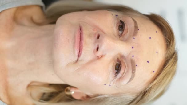 垂直ビデオ 整形手術前の高齢女性の肖像画 60歳の患者の顔のプラスチック手術 4Kビデオ — ストック動画