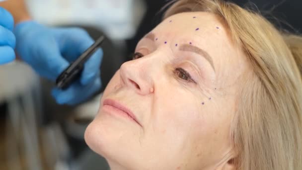 専門の整形外科医は 高齢女性を検査し 整形手術の前に顔のマーキングを行います 現代ヨーロッパの整形外科クリニック — ストック動画