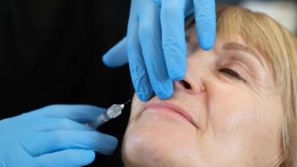 Estetisk Plastikkirurgi Äldre Kvinna Läppförstoring Förfarande Med Botox Injektioner Video — Stockvideo
