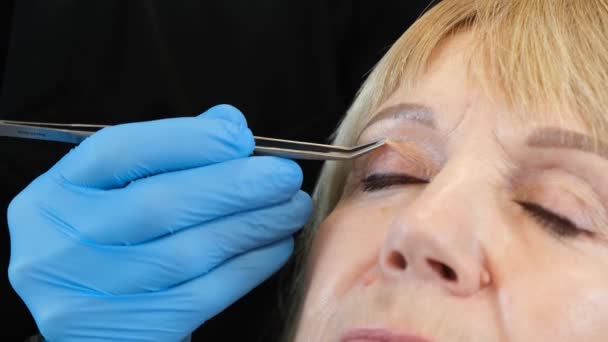 Bir Plastik Cerrah Yaşlı Bir Kadında Eski Göz Kırışıklıklarını Inceler — Stok video