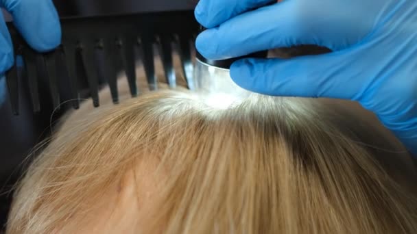 Врач Трихолог Осматривает Волосы Женщин Пациентов Помощью Трихоскопа Клинике — стоковое видео