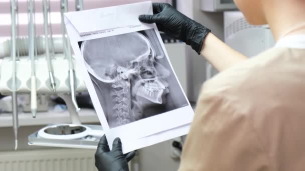 Chirurgo Plastico Esamina Una Radiografia Una Testa Paziente Sparatoria Ravvicinata — Video Stock