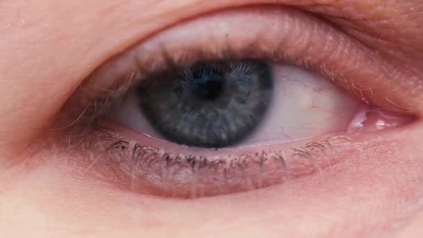 Крупный План Женского Сине Серого Глаза Красные Глаза Переутомления Макровидео — стоковое видео