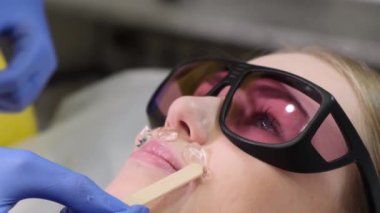 Laser removal of facial hair in women. A cosmetologist performs hardware laser hair removal on a patient in an aesthetic medicine clinic.