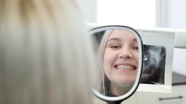 Satisfied Patient Looks Healed Teeth Dental Mirror Result Dental Treatment — Stockvideo