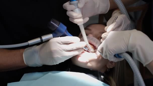 Процес Стоматологічного Лікування Стоматологічному Кріслі Імплантована Стоматологія Заповнення Зубів — стокове відео