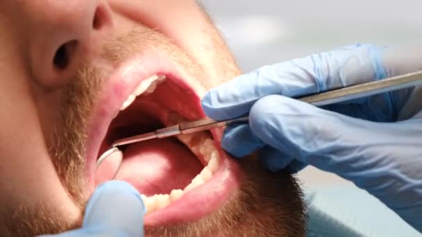 Ένας Επαγγελματίας Οδοντίατρος Εξετάζει Δόντια Ενός Άνδρα Έννοια Της Οδοντιατρικής — Αρχείο Βίντεο