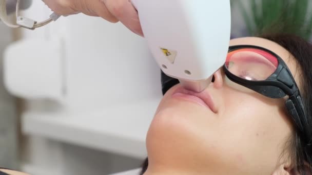 Depilação Laser Rosto Remoção Pêlos Área Acima Dos Lábios — Vídeo de Stock