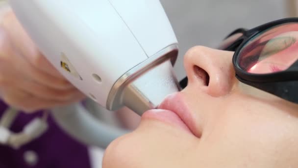 Laser Epilation Face Removal Hair Area Lips — Vídeo de stock