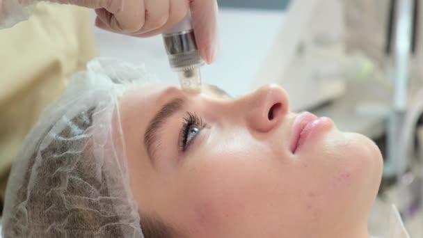Beautiful Woman Undergoes Vacuum Hydropiling Procedure Beauty Salon Facial Rejuvenation — стоковое видео