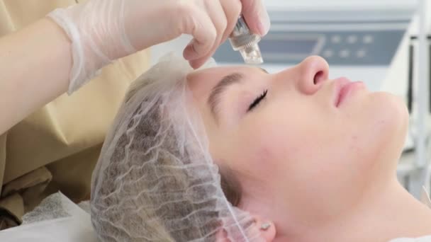 Side View Woman Receiving Microdermabrasion Therapy Forehead Beauty Spa Cosmetology — Vídeo de Stock