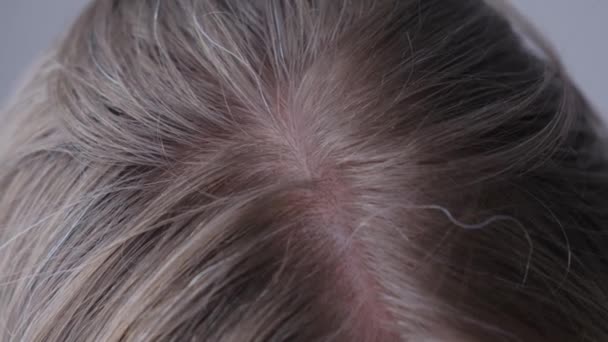 Detailní Záběr Mladé Ženy Šedými Vlasy Rané Šedé Vlasy Problémy — Stock video