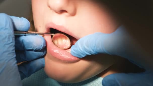 Besök Barnet Till Tandläkaren Undersökning Tänderna Karies Mjölktänder Tandvård Barn — Stockvideo