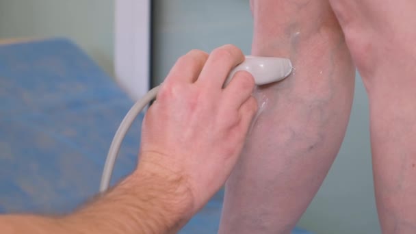 Chirurg Naczyniowy Wykonuje Badanie Ultrasonograficzne Żył Pacjentów Zapobieganie Żylakom Zakrzepicy — Wideo stockowe