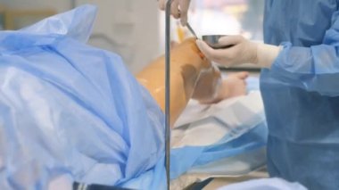 Venöz damar ameliyatının cerrahi kliniği için ameliyathanede bulunan bir phlebologist varisli damarlar için bacakları ameliyat eder. Modern yenilikçi ameliyat tekniği