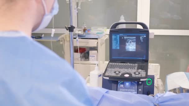수술중에 외과의사는 클램프 전문화 도구와 도구와 기술을 수술의 — 비디오