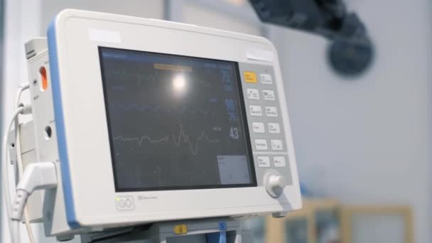 수술중에는 컴퓨터 심박수 모니터를 클로즈업 — 비디오