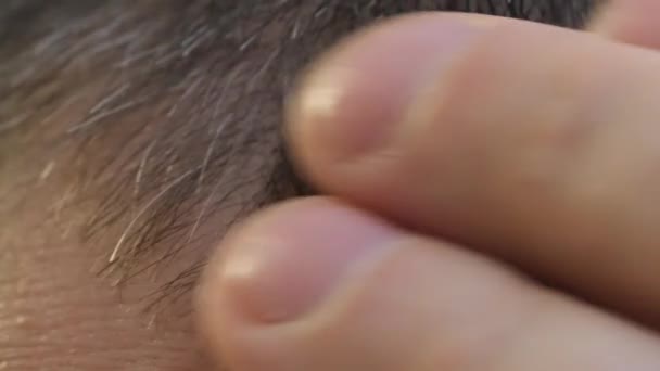 Крупный План Человека Изучающего Седые Волосы Беспокойный Молодой Парень Изучает — стоковое видео