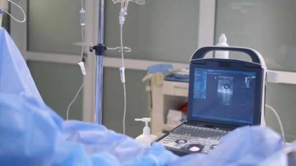 종양학자는 현대적 혁신적 기술을 사용하여 정맥류 정맥을 다리의 초음파를 합니다 — 비디오