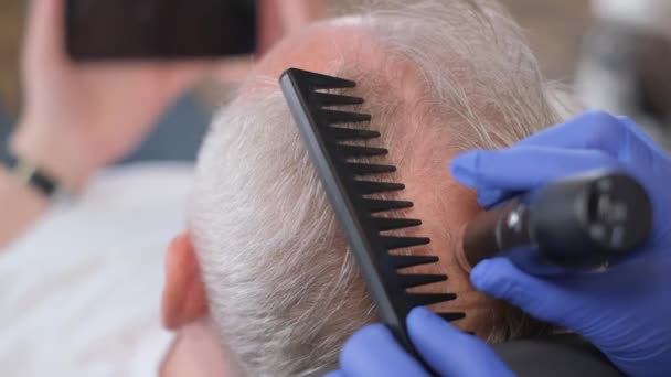 Kadın Doktor Trikoloğu Saç Uzaması Için Klinikte Kel Olgun Bir — Stok video