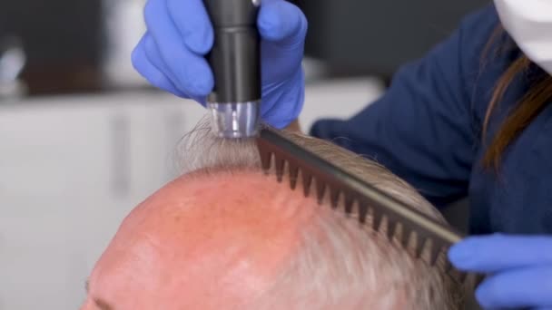Der Senior Wird Von Einem Trichologen Untersucht Haarpflegekonzept Filmmaterial — Stockvideo