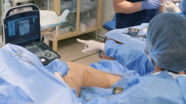 医生对静脉曲张 腿部肿胀和扭曲静脉进行手术 外科医生实施静脉曲张的治疗方法 — 图库视频影像