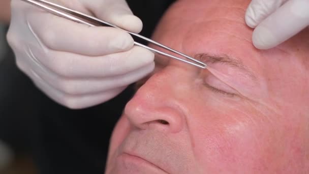 Surgeon Examines Face Old Man Plastic Surgery Change Eye Area — Stock Video